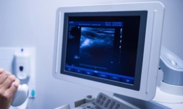 Ultrasound Near Me Locations – 3D & 4D Sonogram Clinics